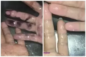 Tanpa perlu pakai sabun, ini cara menghilangkan getah pisang di tangan pakai 2 bahan