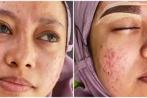 Skill makeup diuji, MUA ini berhasil bikin kliennya yang sedang breakout jadi manglingi