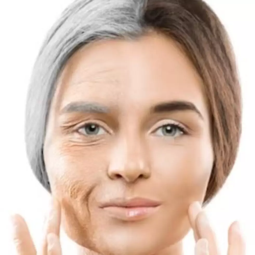 Cara atasi kerutan pada garis senyum pakai serum dari 1 jenis bunga, bikin wajah awet muda