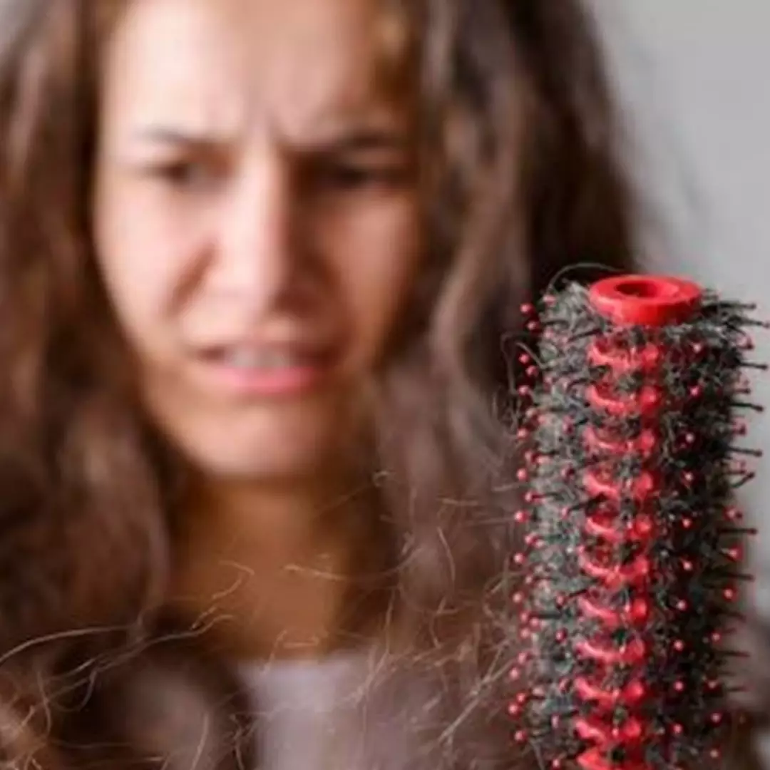 Kembali bersih dan sehat, begini cara atasi rambut berketombe hanya pakai 1 bumbu dapur
