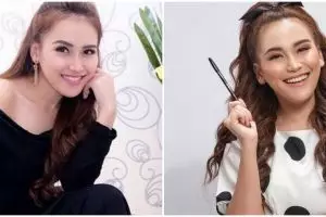 Potret Ayu Ting Ting sebelum dan sesudah tanam benang, hidung jadi kian mancung