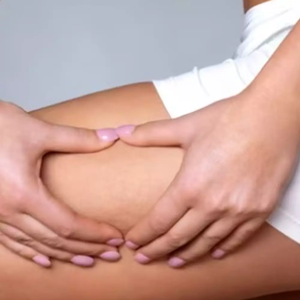 Tidak perlu krim pemutih, ini 9 cara mencerahkan kulit pangkal paha yang menghitam