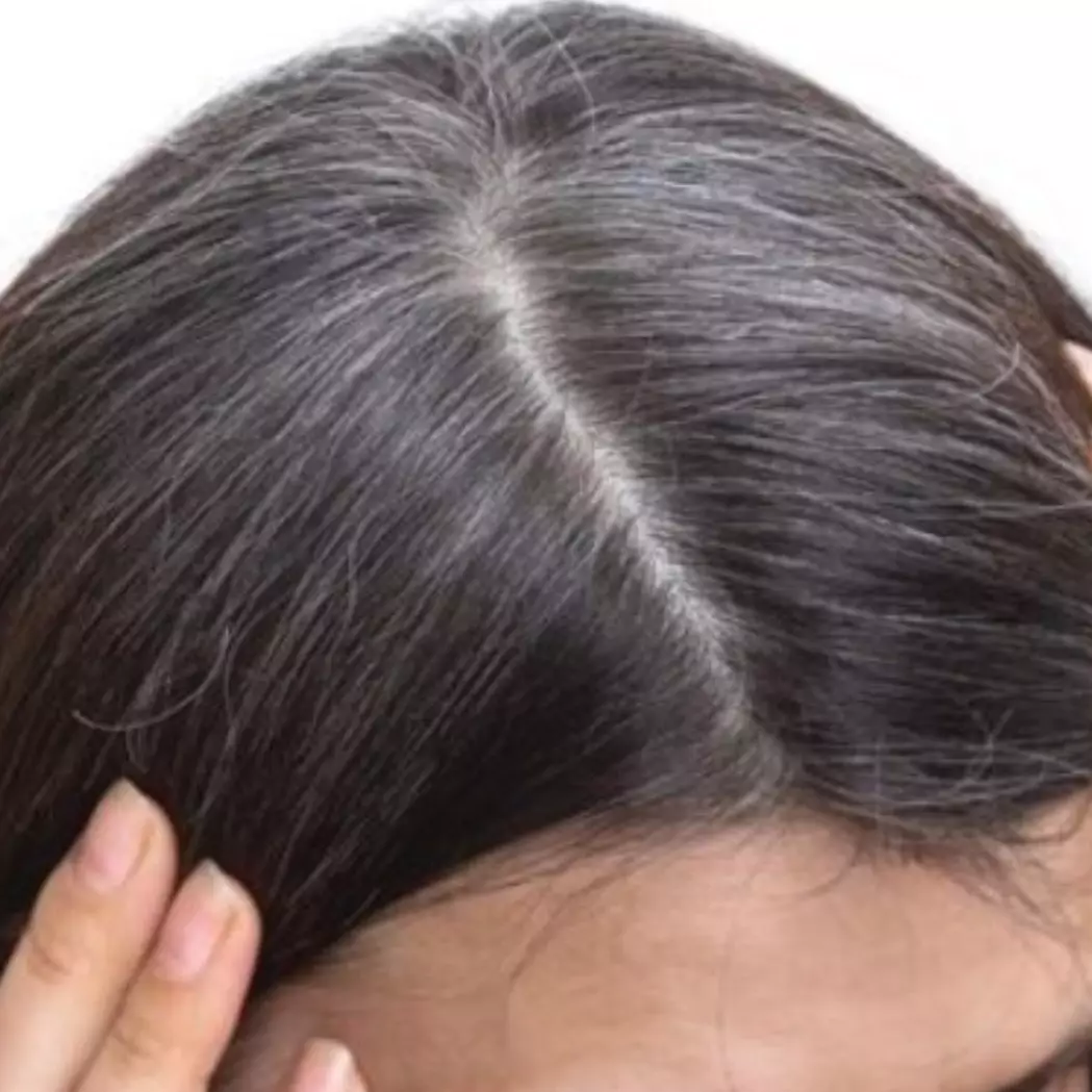 Cara mengurangi uban pada remaja agar rambut sehat dan hitam, cuma pakai 5 bahan alami