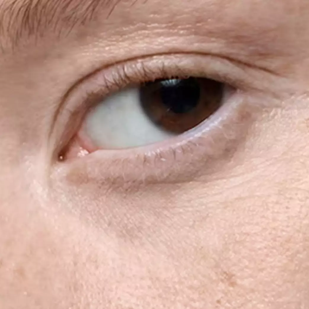 Hanya pakai 1 buah, begini cara atasi bintik hitam pada wajah agar kembali cerah