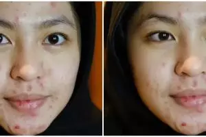 Wanita berjerawat ini dirias MUA jadi pengantin dengan siger Sunda, hasil makeupnya manglingi