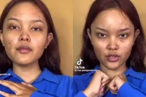 Wanita penuh bekas jerawat ini dimakeup ala Jisoo BLACKPINK di video klip Flower, hasilnya bikin kagum