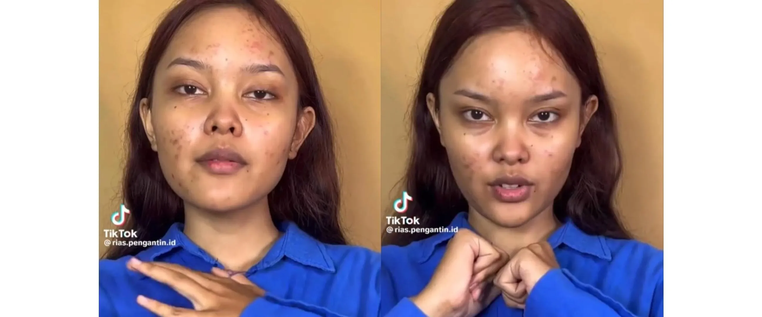 Wanita penuh bekas jerawat ini dimakeup ala Jisoo BLACKPINK di video klip Flower, hasilnya bikin kagum