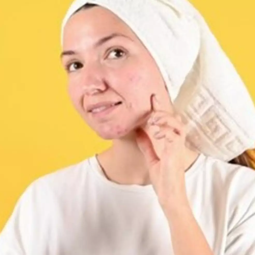 9 Rekomendasi sunscreen untuk kulit berjerawat harga mulai Rp 30 ribuan