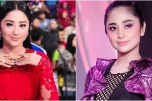Penampilan terbaru Dewi Perssik usai transfer lemak disebut terlihat tua, ini 9 potret dulu & kininya