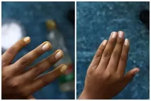 Jangan cuma pakai baking soda, ini cara cepat bersihkan noda kunyit di kuku tangan