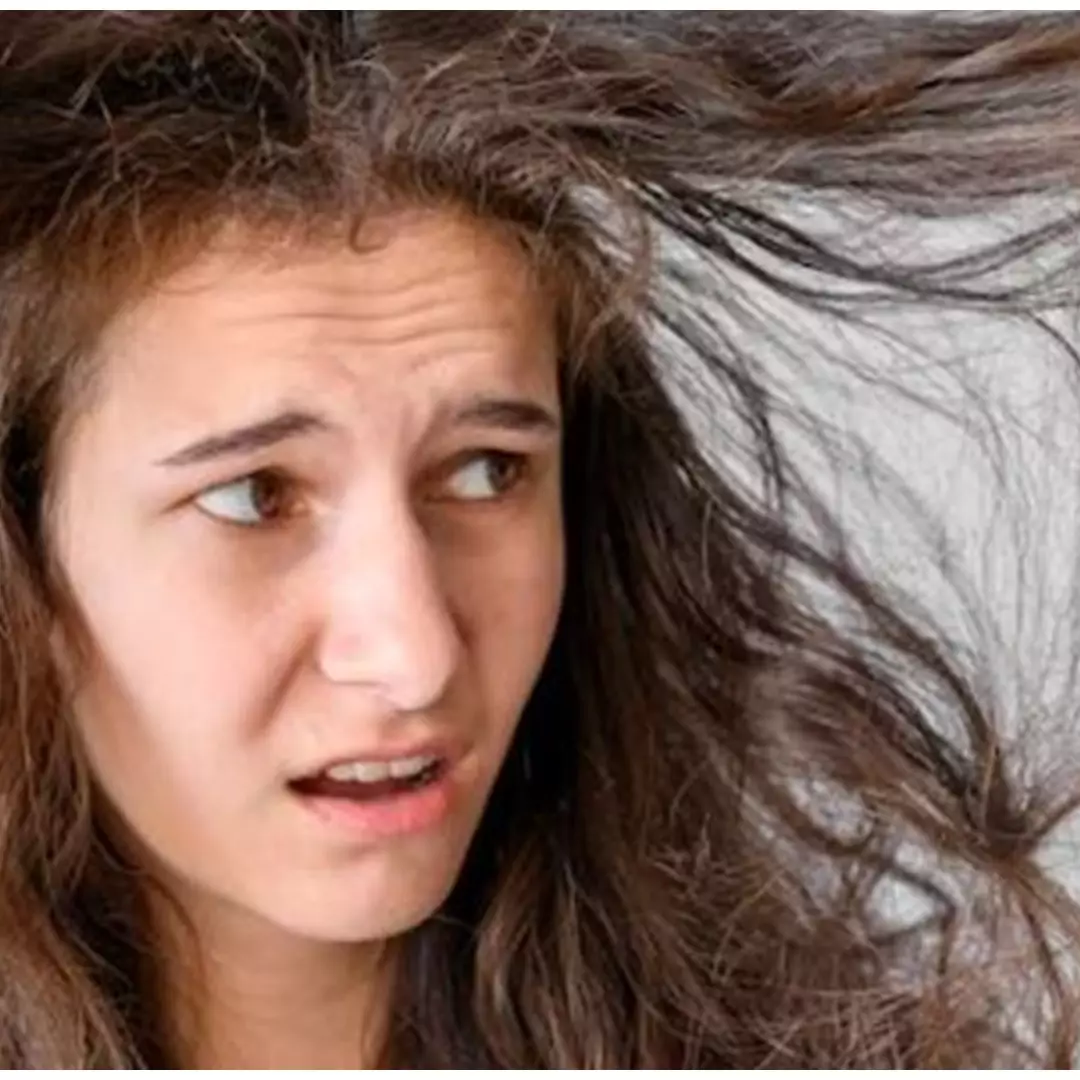 Trik atasi kerontokan pada kulit kepala pakai 1 jenis minuman ini bikin rambut tumbuh lebat &amp; berkilau