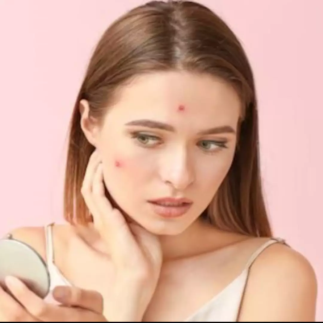 Wajah mulus dan cerah, ini cara membuat masker untuk cegah munculnya jerawat pakai 2 bahan dapur