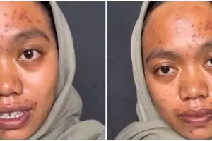 Transformasi wanita berjerawat dirias MUA jadi pengantin sunda, hasilnya dipuji mirip Lesty Kejora