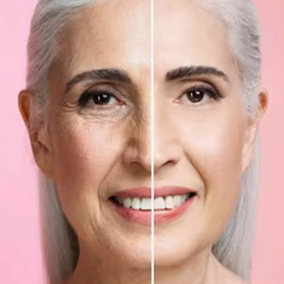 Bikin kulit auto cerah, ini trik hilangkan kerutan di wajah hanya pakai 1 bahan lalapan