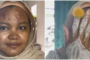 Tak pede muka penuh jerawat batu, penampilan wanita usai dirias MUA jadi manten Jawa ini auto mulus
