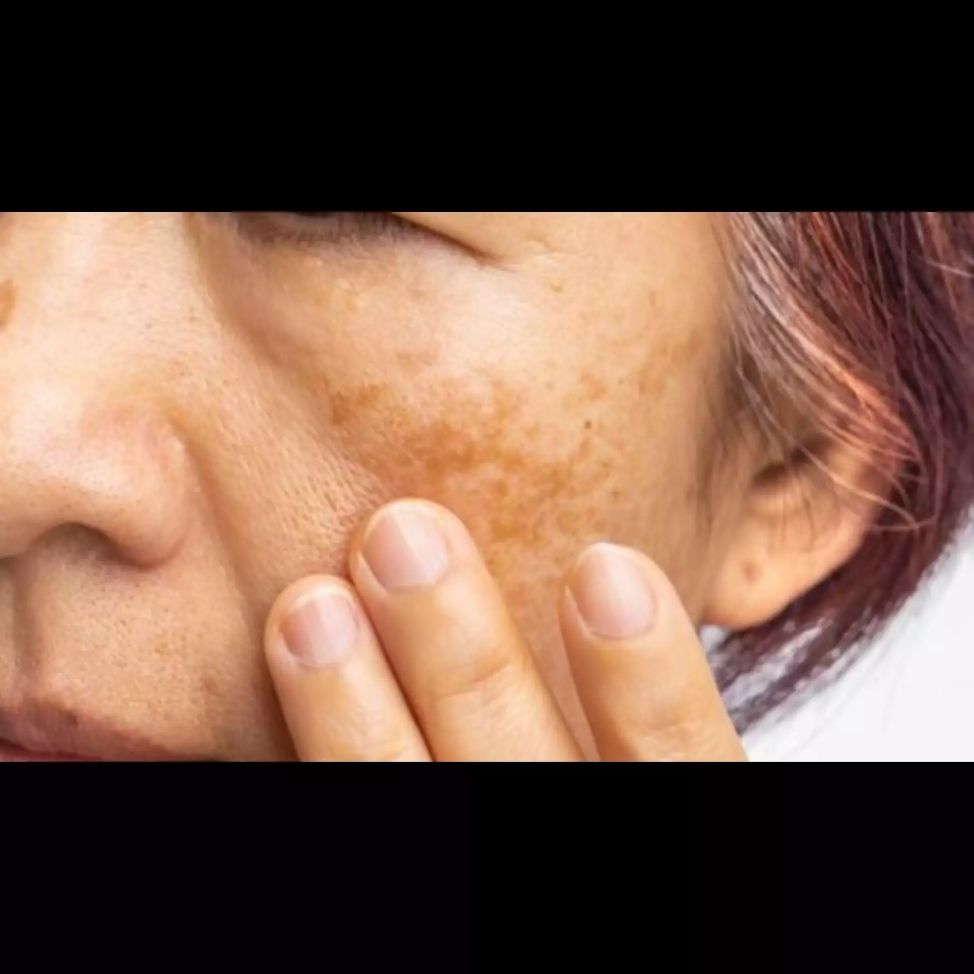 Tak perlu perawatan mahal, ini cara atasi pigmentasi akibat penuaan memanfaatkan masker 1 jenis tepung