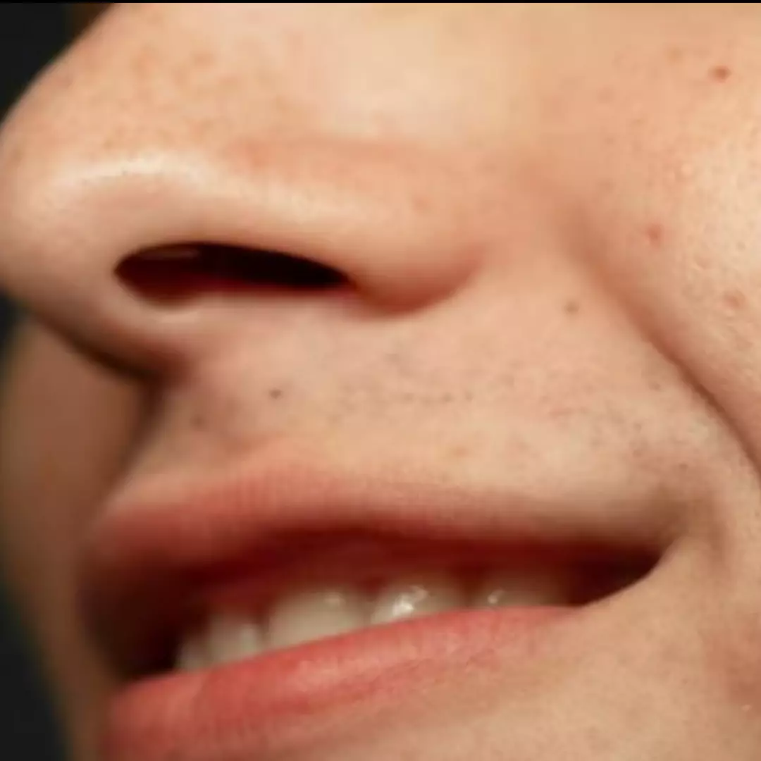 Tak perlu perawatan mahal, begini trik pudarkan flek hitam pakai face oil dari 1 jenis kulit buah