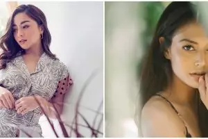 Sekarang sukses di dunia akting, 7 seleb ini sempat ditolak casting, salah satunya punya gigi kelinci