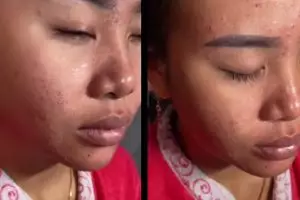 MUA rias wajah pengantin yang berjerawat dan beruntusan H-3 pernikahan, hasilnya bikin nggak nyangka