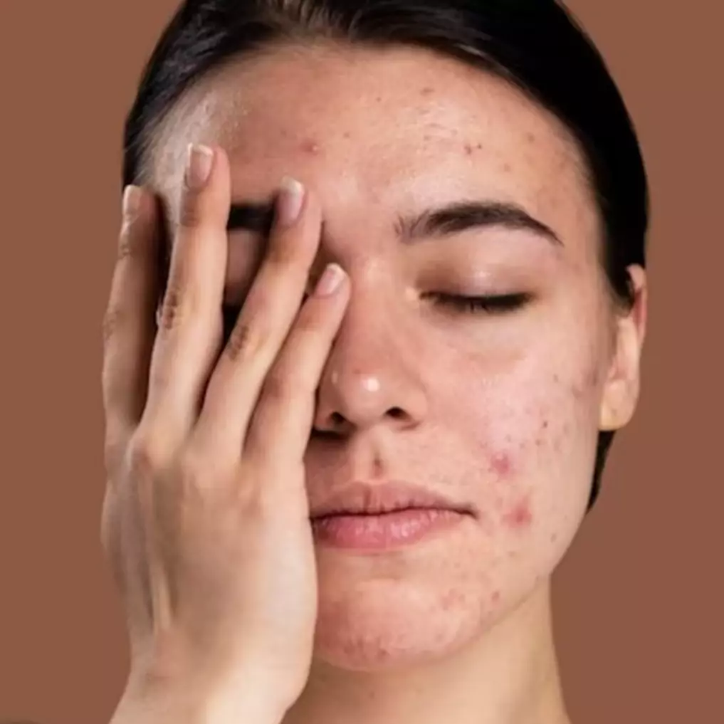 Ampuh hilangkan flek dan noda hitam, ini trik bikin masker whitening dari 1 bahan dapur