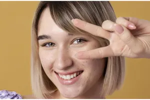 Nggak perlu beli, begini cara atasi pigmentasi hanya pakai krim dari 1 jenis bunga