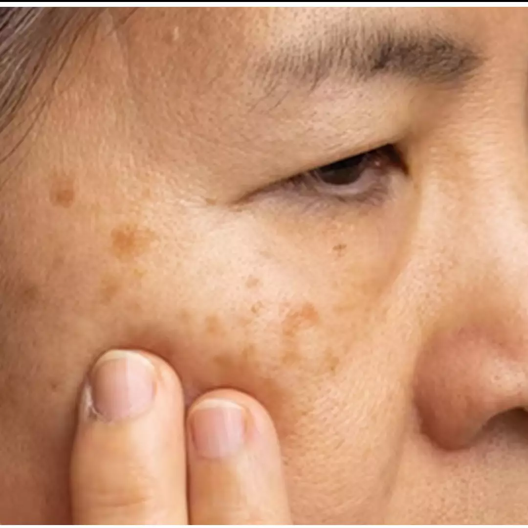 Wajah tak menua dimakan usia, begini trik pudarkan flek hitam hanya pakai 1 jenis sayuran