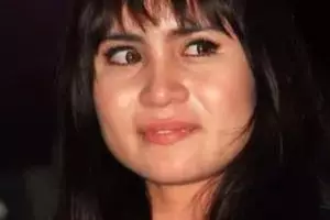 Nasibnya tak terduga, penyanyi ini dulu dihujat karena giginya jelek, kini punya danau di rumahnya