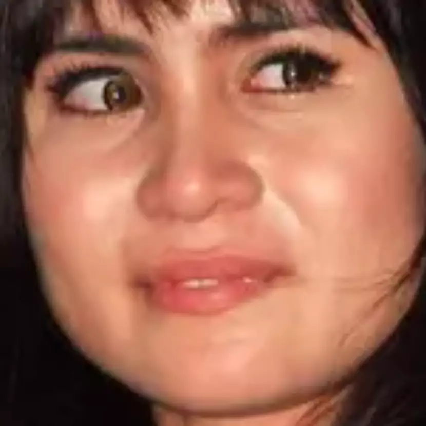 Nasibnya tak terduga, penyanyi ini dulu dihujat karena giginya jelek, kini punya danau di rumahnya