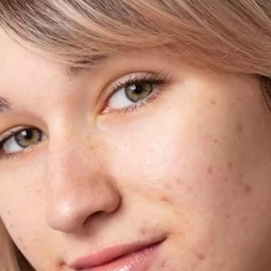 Atasi hiperpigmentasi dan flek, ini trik bikin masker wajah dari 3 bahan dapur