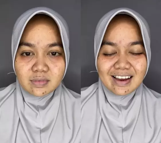 Wanita berjerawat ini auto mulus © TikTok Wanita berjerawat ini auto mulus © TikTok