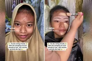 Sering dirundung karena wajah berjerawat, MUA rias wajah wanita ini jadi manglingi di acara wisuda