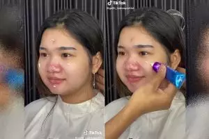 Hidung merah bak badut akibat jerawat, potret wanita chubby dirias MUA ini bikin wajah jadi mulus pol