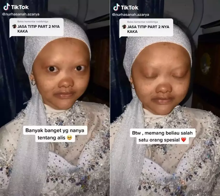 pengantin berwajah spesial © TikTok