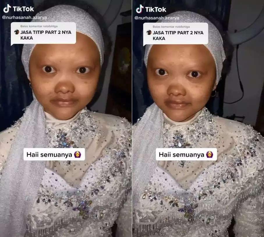 pengantin berwajah spesial © TikTok