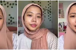 Bukti keajaiban makeup, perubahan wanita berwajah bintik seperti bentol usai dandan bikin takjub