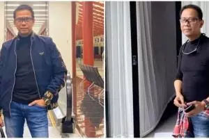 Habiskan Rp 40 juta untuk permak wajah, ini potret terbaru Doddy Sudrajat usai operasi kantung mata