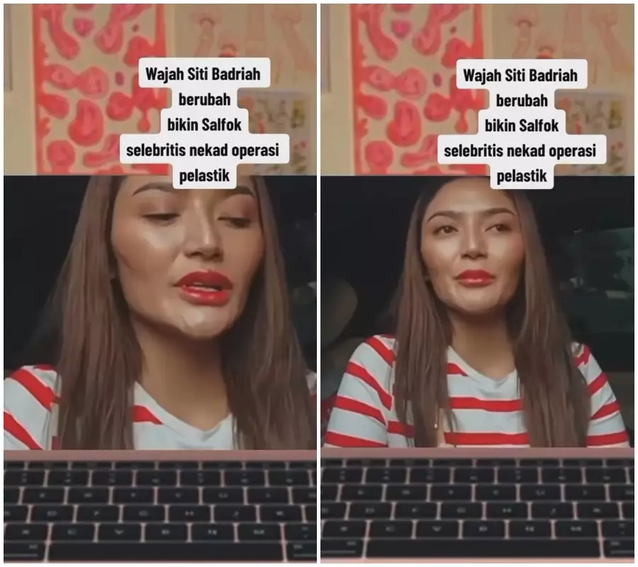 reaksi siti badriah dituduh wajah oplas © TikTok/@krissiti911