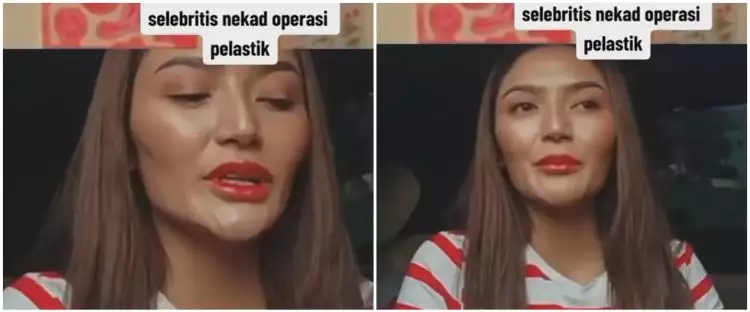Sering digunjing wajahnya operasi plastik, begini reaksi kocak Siti Badriah bareng sang suami