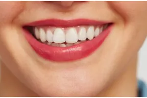 Trik pudarkan karang gigi membandel hanya pakai 1 kulit buah, senyum jadi kinclong dan bersinar