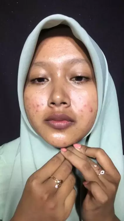 wanita penuh luka jerawat usai dandan © TikTok