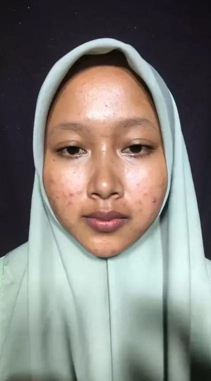 wanita penuh luka jerawat usai dandan © TikTok