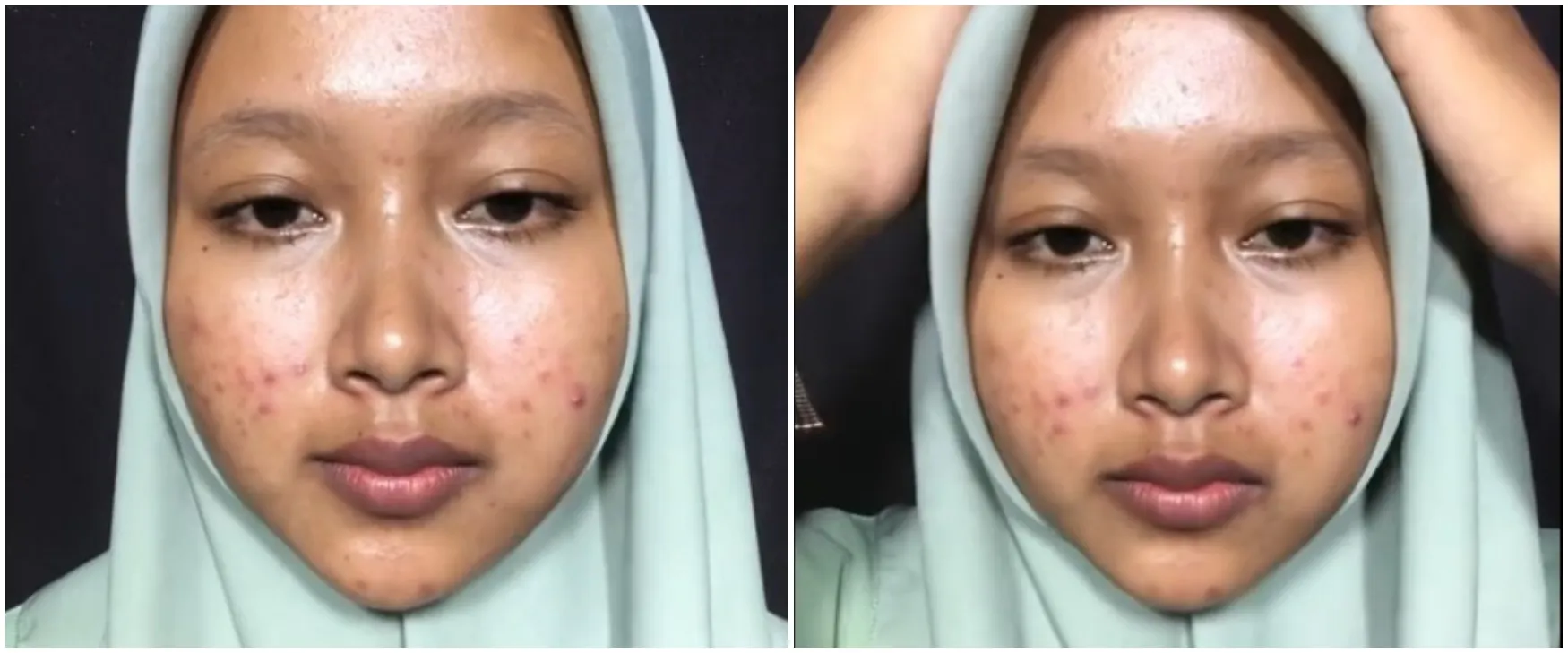 Keajaiban makeup bisa bikin mulus, potret wanita penuh bekas jerawat usai dandan ini bikin susah kedip