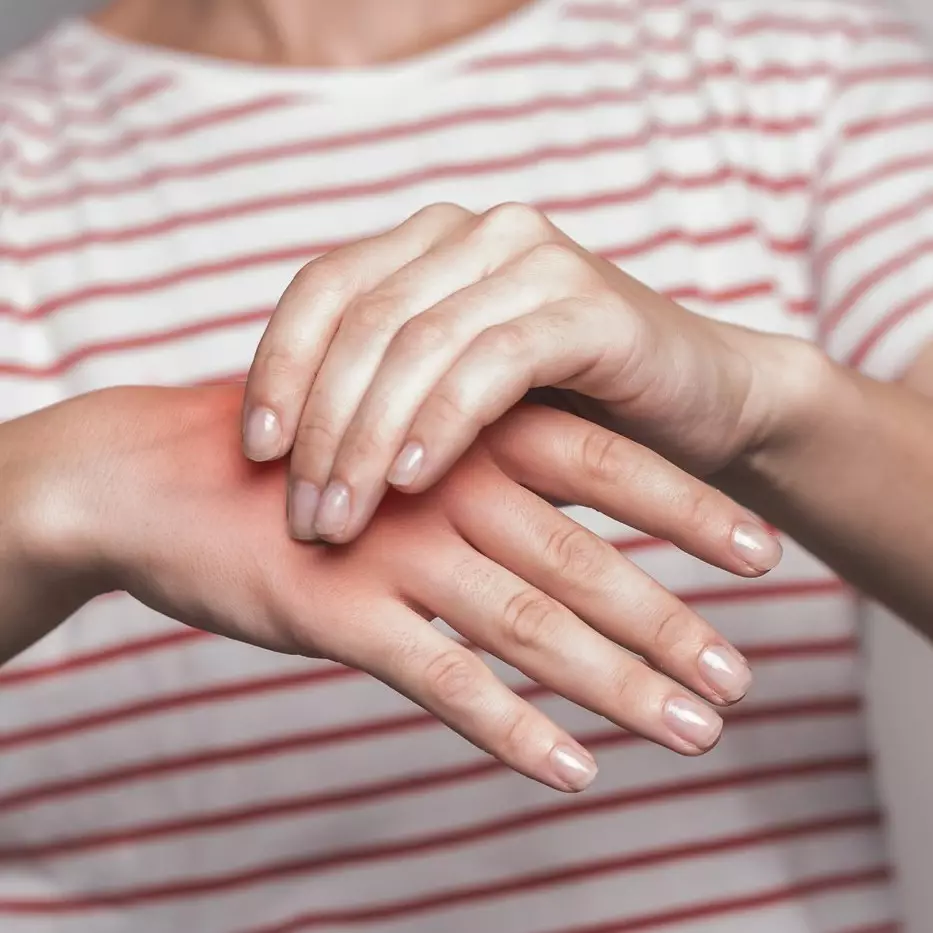 Hanya 2 menit, begini trik hilangkan gatal di sela jari akibat kutu air hanya pakai 1 bahan dapur