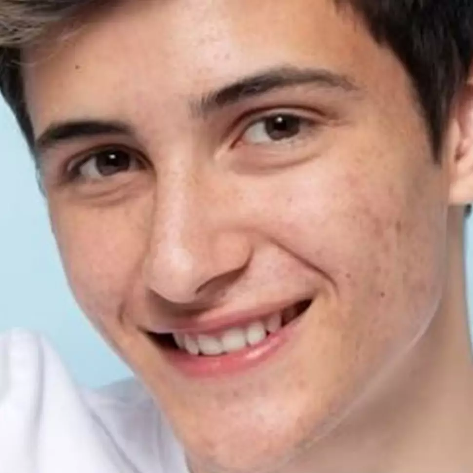 Tampak seperti umur 20 tahun, begini trik pudarkan pigmentasi hanya pakai 1 buah