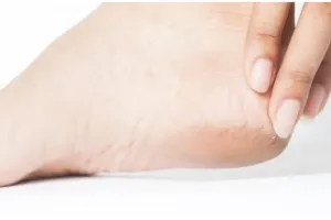 Kulit jadi halus dan mulus, begini trik atasi tumit kaki pecah-pecah dan kering pakai 1 ekstrak buah