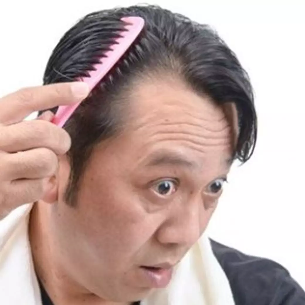 Trik atasi kebotakan di sekitar dahi pakai hair mask dari 1 jenis daun, bikin kembali tumbuh lebat