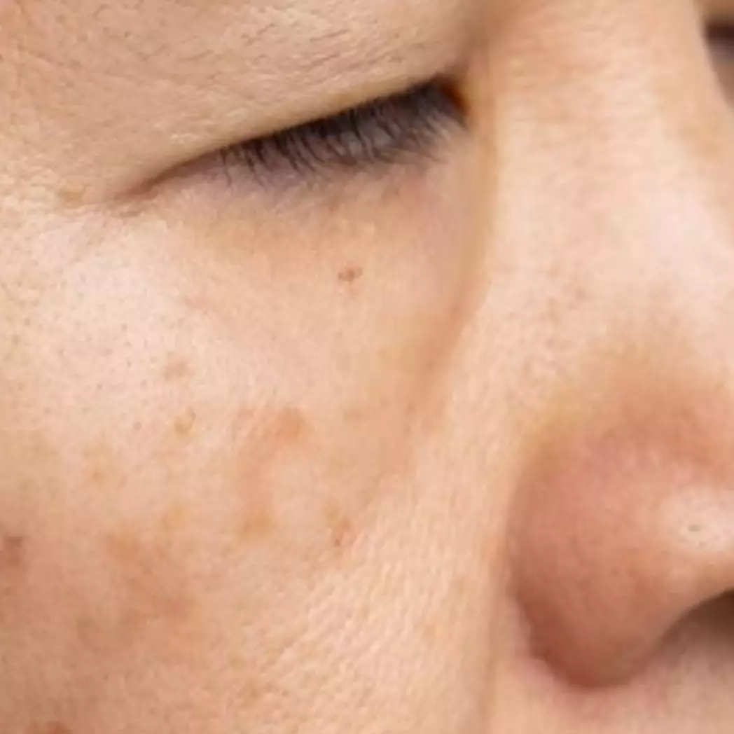 Bukan perawatan mahal, ini cara menghilangkan flek hitam karena efek penuaan pakai 1 jenis sayuran