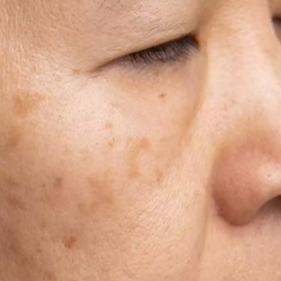 Lawan penuaan dan kulit belang, ini cara simpel gunakan 1 jenis buah agar wajah jadi cerah berseri