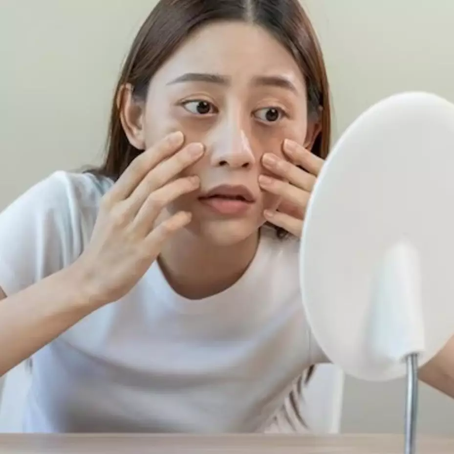 Hanya dalam 3 hari, ini cara pudarkan bengkak dan garis halus pada mata panda pakai 1 jenis daun