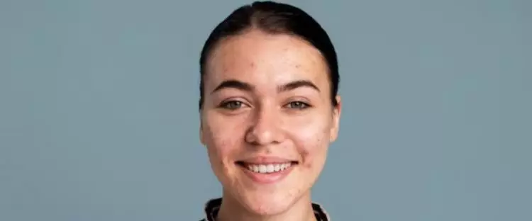 Tak perlu serum antiacne, ini trik mengatasi jerawat pakai scrub wajah dari 1 jenis buah